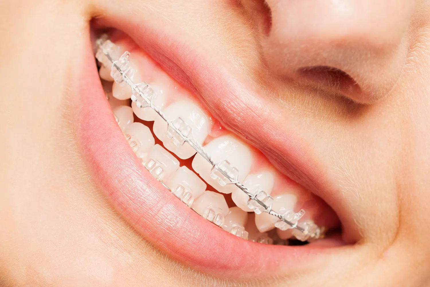 Dental Implants In Gilbert, AZ